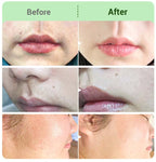 ✨Haarentfernungscreme-Set für Frauen