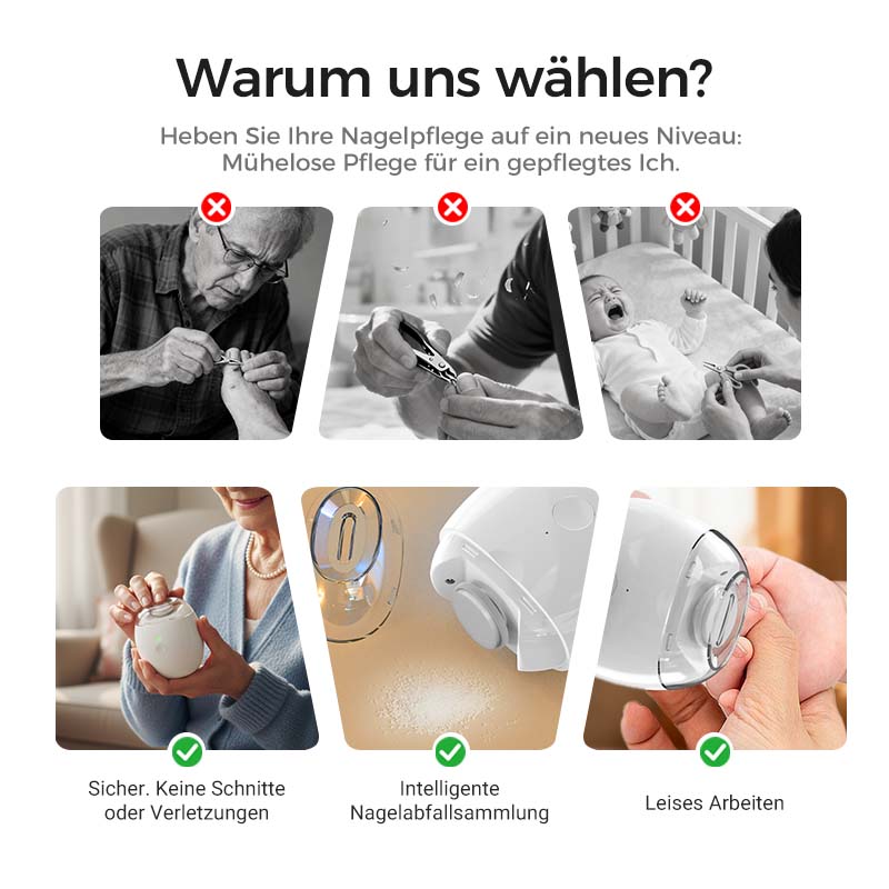 💅✨ Multifunktionaler elektrischer Nagelknipser – Schnell, präzise & sicher für die ganze Familie! ✨😌 Sanfte Pflege für gesunde Nägel, einfach & hygienisch.