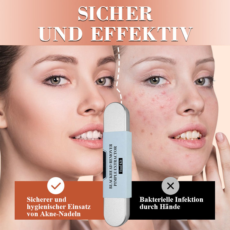 ⚡ 50% RABATT! ✨ EDELSTAHL-MITESSERENTFERNER - 7-teiliges Set für Tiefenreinigung, Präzisionswerkzeuge für Gesichtspflege, Sterilisierbar und Hautschonend 🌟🧴