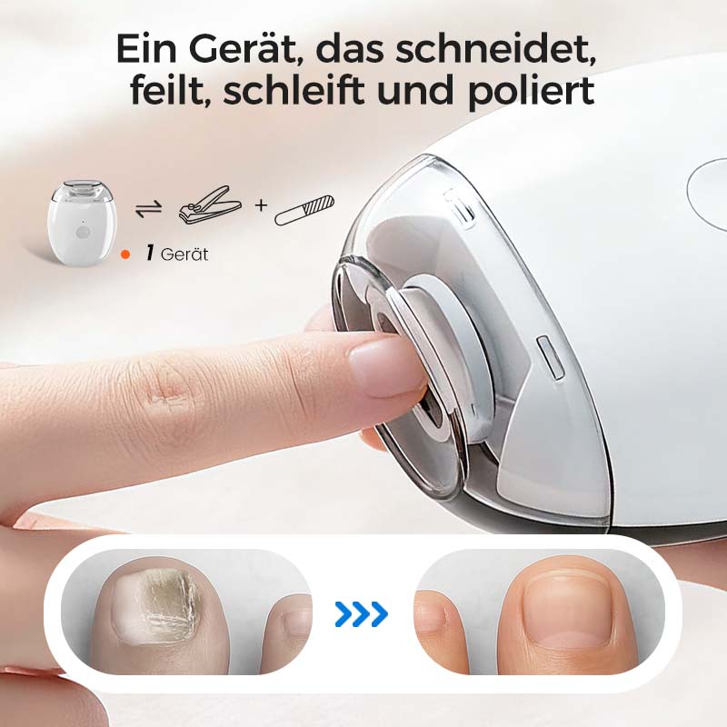 💅✨ Multifunktionaler elektrischer Nagelknipser – Schnell, präzise & sicher für die ganze Familie! ✨😌 Sanfte Pflege für gesunde Nägel, einfach & hygienisch.