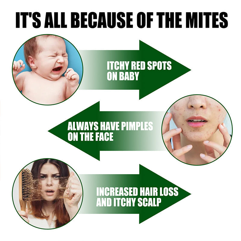 🐛 🐛POWER-INSEKTENSPRAY - Sofortige Wirkung gegen Fliegen/Mücken🌿🌿Geruchsneutral & Hautfreundlich, Ideal für Haus und Garten