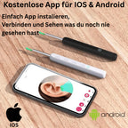 ⏳Begrenzte Zeit 50% Rabatt💥Intelligenter wasserdichter visueller Ohrenschmalzentferner