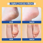🧴👣 24h feuchtigkeitsspendende Fußcreme mit Urea 🧦✨ – Ideal für trockene, rissige Füße, intensive Pflege und Geschmeidigkeit, 49 % Rabatt nur heute!