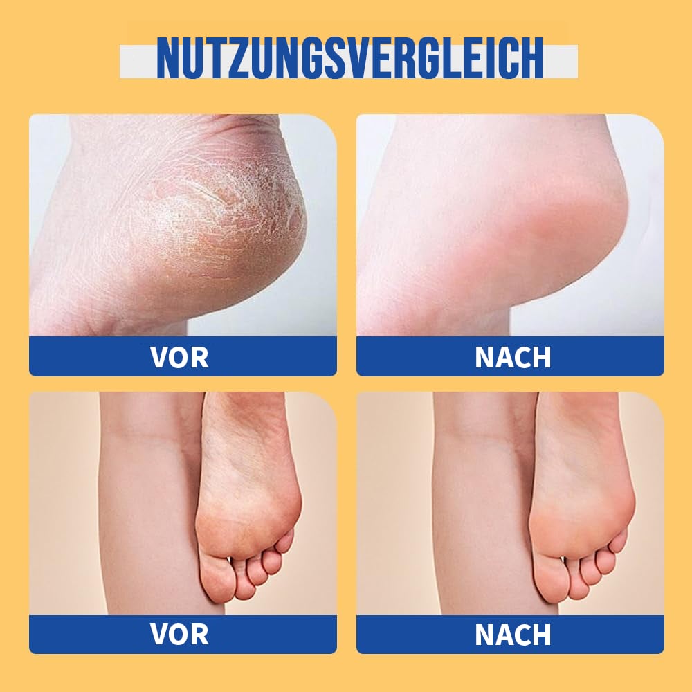 🧴👣 24h feuchtigkeitsspendende Fußcreme mit Urea 🧦✨ – Ideal für trockene, rissige Füße, intensive Pflege und Geschmeidigkeit, 49 % Rabatt nur heute!