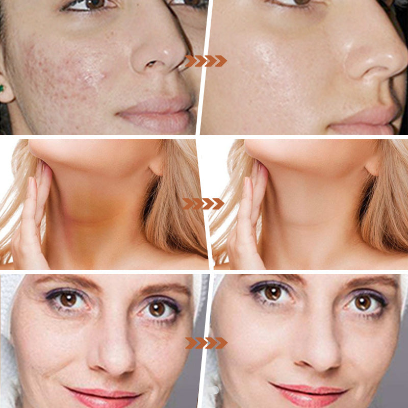 🍋🧼✨ Aufhellende Zitrone & Kurkuma Seife mit Kojisäure ✨🌿 – Strahlender Teint, natürliche Pflege für nachhaltige Schönheit