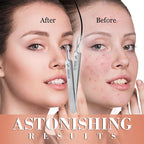 🔥🔥Kürzlich 10.000 Einheiten verkauft ~ Befristeter Sonderpreis🌟🌟Spezialisierte Pinzetten für Schönheitssalons