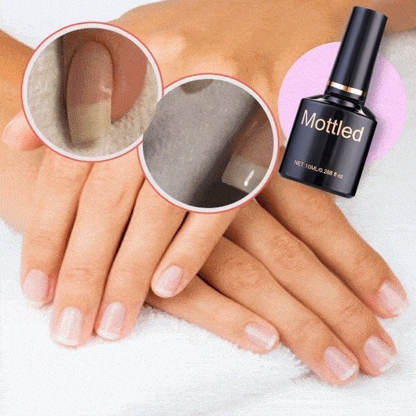 🌟2025 Schutzgel für Nagelreparatur💅 kaufen 2 Holen Sie sich 1 kostenlos