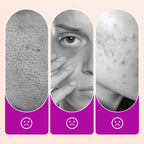 ✨🔥 2 kaufen, 1 gratis – Flawless Under Eye Concealer: Hellen Sie dunkle Ringe auf & reduzieren Falten ✅🌿 Vegan und langanhaltend für strahlende Augen