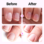 💜 1 KAUFEN, 1 GRATIS 💜 Neues 2025 Upgraded 3-in-1 Nagelpflege-Stift 💅