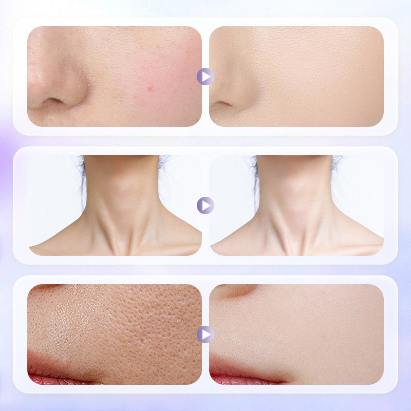 🎀🎀Aktuell im Trend 🎁🎁Langanhaltende, leichte Gesichtscreme für strahlende, aufgehellte Haut