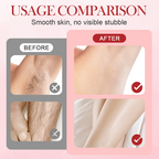 🦠✨ Intimhygiene-Risiken beenden! Doppelkopf-Epilierer entfernt Haare & Keime effektiv – für langfristig glatte und gesunde Haut ✨🦠