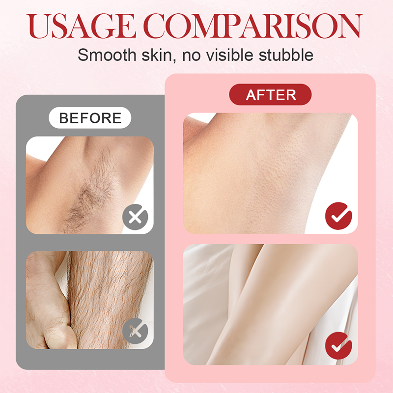 🦠✨ Intimhygiene-Risiken beenden! Doppelkopf-Epilierer entfernt Haare & Keime effektiv – für langfristig glatte und gesunde Haut ✨🦠