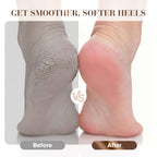 ❤️❤️Pflegen Sie Ihre Fersen gut - 44%Rabatt🕺🕺Stoßdämpfender und atmungsaktiver Fersenschutz