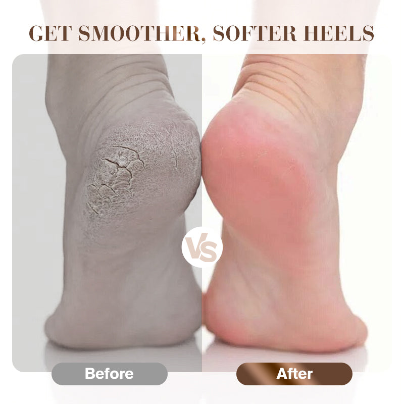 ❤️❤️Pflegen Sie Ihre Fersen gut - 44%Rabatt🕺🕺Stoßdämpfender und atmungsaktiver Fersenschutz
