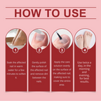 💅🌟 Nägel Reparatur Essenz – Stärkt & regeneriert beschädigte Nägel in 7 Tagen! ✨💪 Sichtbare Ergebnisse, dermatologisch getestet. Deine Lösung für starke, gesunde Nägel.