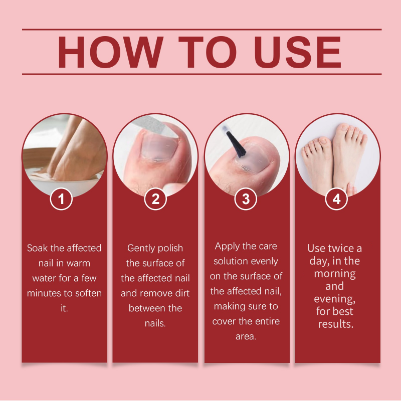 💅🌟 Nägel Reparatur Essenz – Stärkt & regeneriert beschädigte Nägel in 7 Tagen! ✨💪 Sichtbare Ergebnisse, dermatologisch getestet. Deine Lösung für starke, gesunde Nägel.