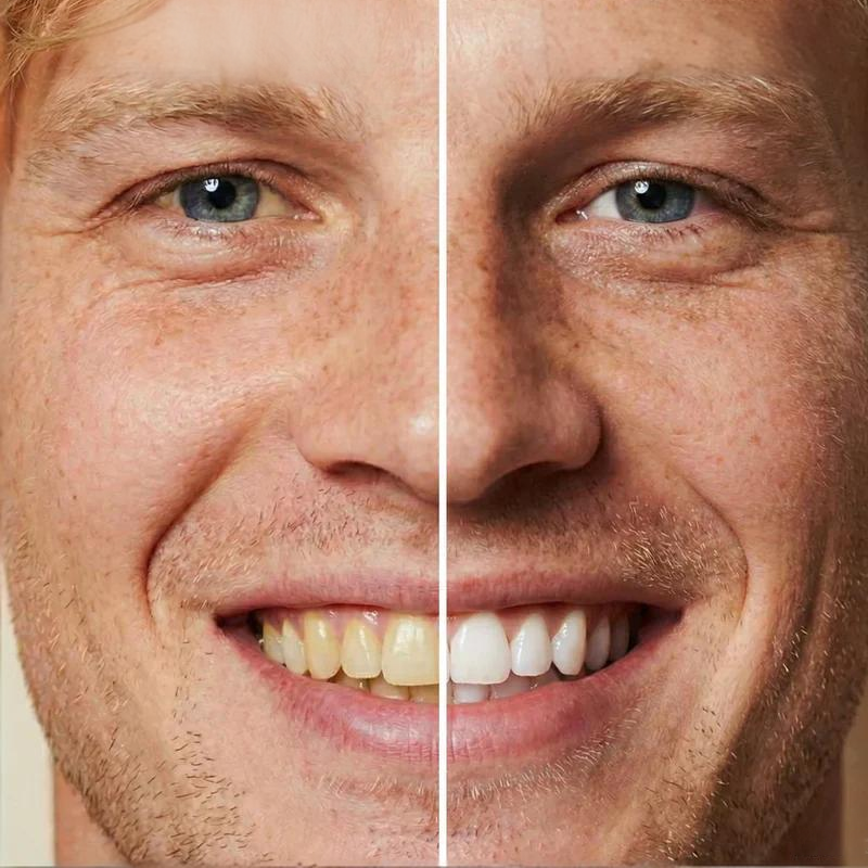 🦷🏆 Sofort strahlend – 50% Neukundenrabatt 2026! 🧴✨ 5 ml Aufhellende Zahnfarbe für sofortige Wirkung & spürbare Frische. Professionelle Pflege für dein natürliches Lächeln. Jetzt nachhaltig glänzen!