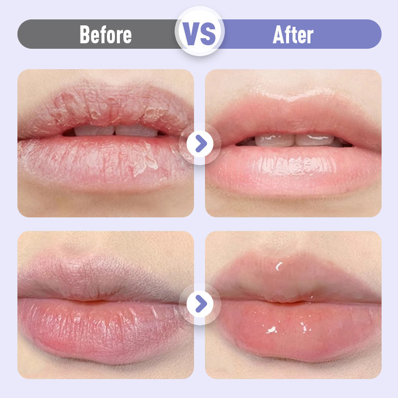 💋✨ Aufpolsterndes & feuchtigkeitsspendendes Anti-Falten-Lippenserum ✨🌿 Intensivpflege für pralle Lippen – mit natürlichen Wirkstoffen & nachhaltiger Formel.