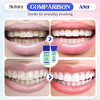 🦷✨ Zahnpasta Gentle Care – Tägliche Aufhellung mit Natürlichem Schutz ✨🌿 Effektiv. Nachhaltig. Für ein selbstbewusstes Lächeln. (Jetzt 50% Rabatt für kurze Zeit!)