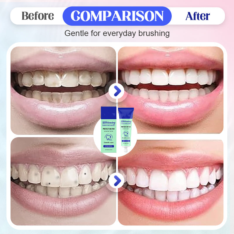 🦷✨ Zahnpasta Gentle Care – Tägliche Aufhellung mit Natürlichem Schutz ✨🌿 Effektiv. Nachhaltig. Für ein selbstbewusstes Lächeln. (Jetzt 50% Rabatt für kurze Zeit!)