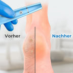 🦶⚡ Elektrischer Hornhautentferner – Sanfte, effektive Fußpflege für glatte Haut ohne Anstrengung! ✨😌