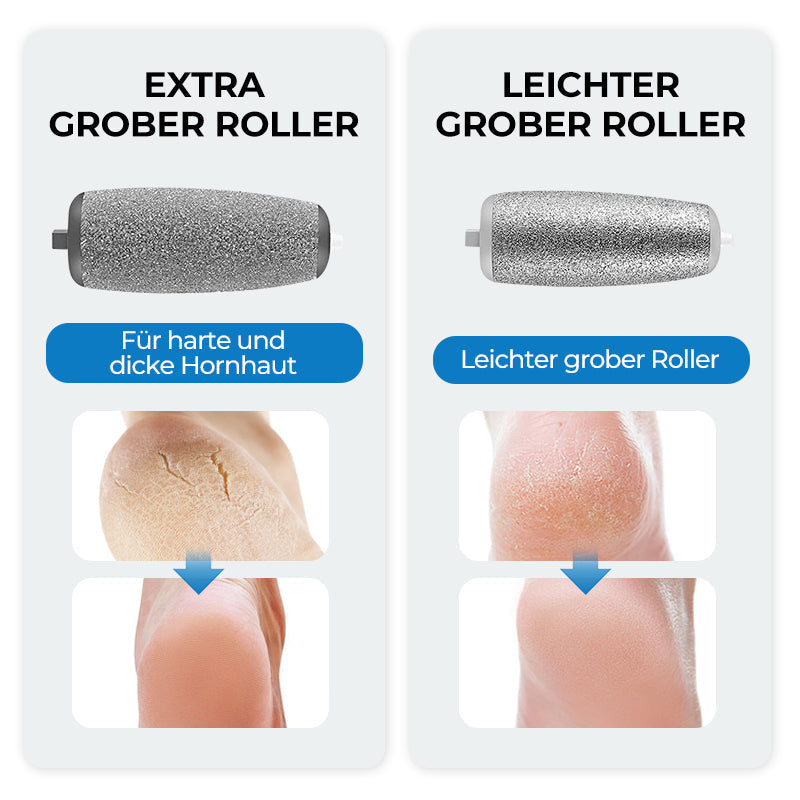 🦶⚡ Elektrischer Hornhautentferner – Sanfte, effektive Fußpflege für glatte Haut ohne Anstrengung! ✨😌