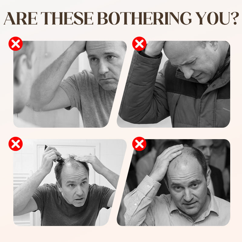 🌟🧢 Unisex-Perückenkappe – für alltägliche Hip-Hop-Frisuren ohne Limits! 💃✨ Atmungsaktiv & langlebig, perfekt für Style & Aktivität.