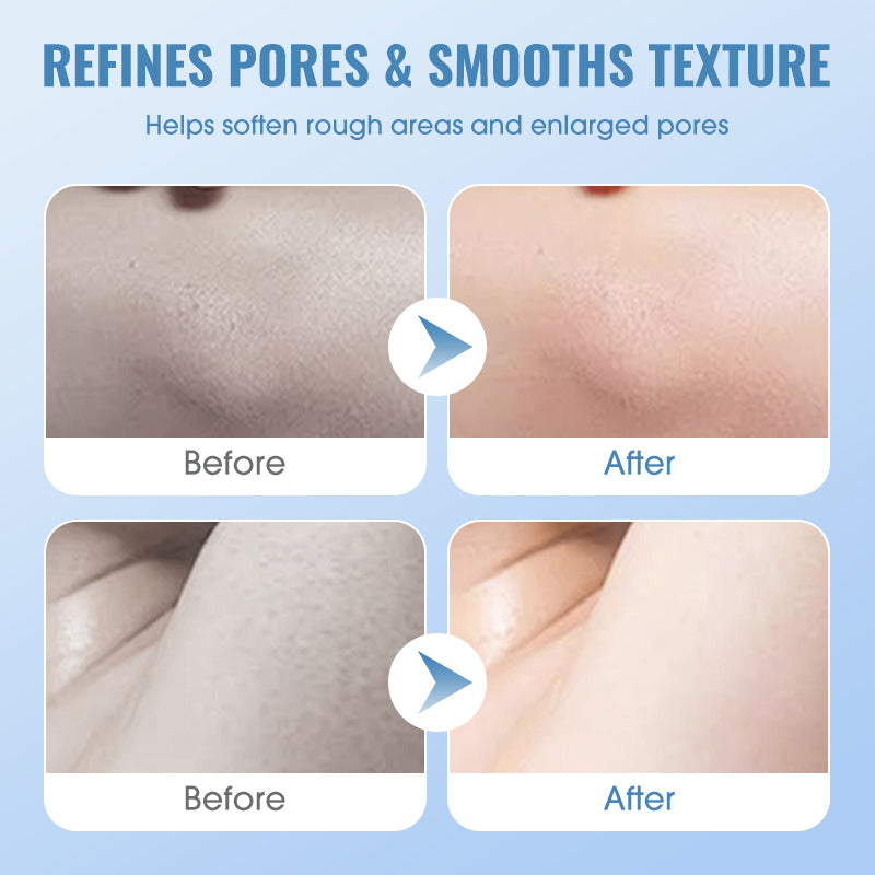 🧴✨ Tiefenreinigendes Peeling-Gel für glattere Haut & verfeinerte Poren 🌿💧 mit hautschonendem pH 5.5