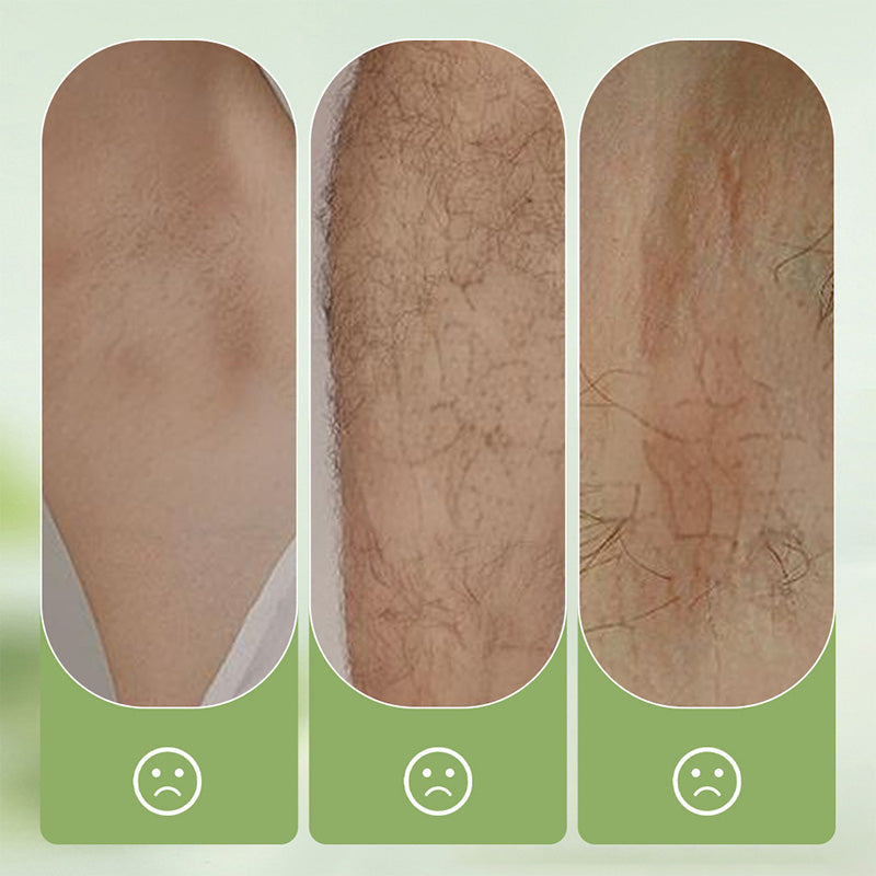 ✨🪒 Sanfte Haarentfernungscreme + Rasierer Set ✨🌸 – Hautfreundlich, streifenfrei & rasiert glatt. Ideal für empfindliche Haut. Perfekt für Zuhause & Reisen. Zeitlich begrenztes Angebot 🎁